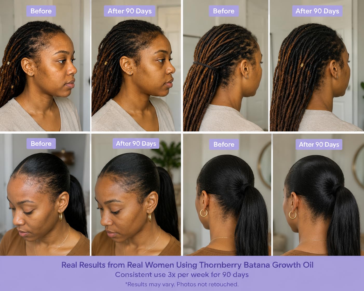 Batana Hair Growth Oil For Hair Loss & Thicker Hair - Image 6