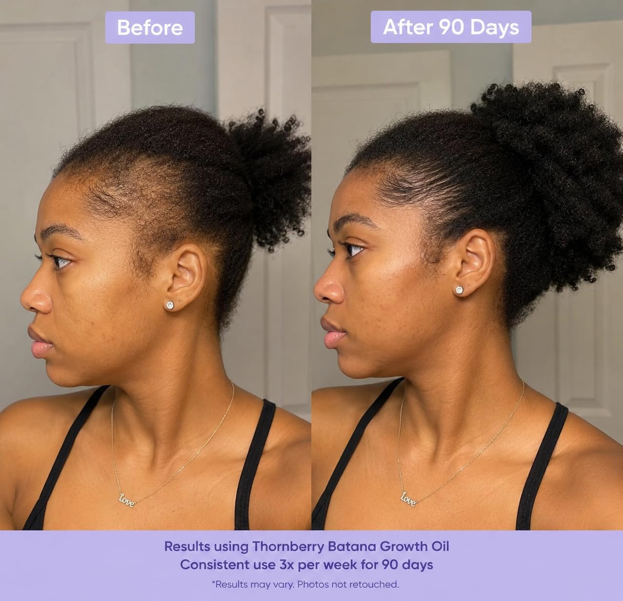 Batana Hair Growth Oil For Hair Loss & Thicker Hair - Image 9